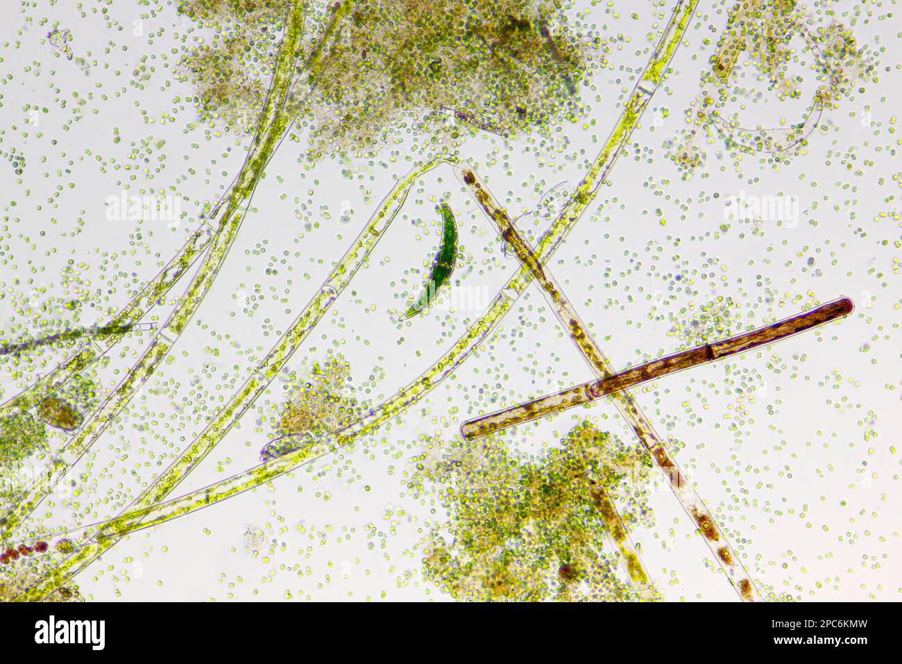 Mikroskopische Darstellung des Detritus mit verschiedenen Süsswasseralgenarten. Hellfeldbeleuchtung. Stockfoto