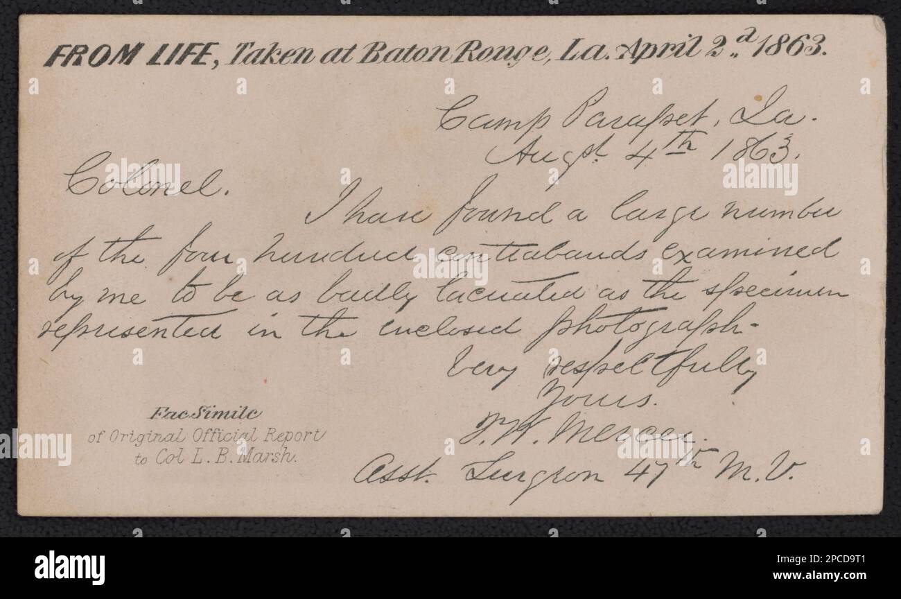 Entflohener Sklave Gordon, auch bekannt als „Peitsche Peter“, zeigt seinen Narbenrücken bei einer medizinischen Untersuchung, Baton Rouge, Louisiana. Liljenquist Family Sammlung von Bürgerkriegsfotos, pp/liljpaper. Afroamerikaner, Strafe & Folter, 1860-1870, flüchtige Sklaven, Louisiana, Baton Rouge, 1860-1870, Wunden & Verletzungen, 1860-1870, USA, Geschichte, Bürgerkrieg, 1861-1865, Afroamerikaner, Louisiana, Baton Rouge. Stockfoto