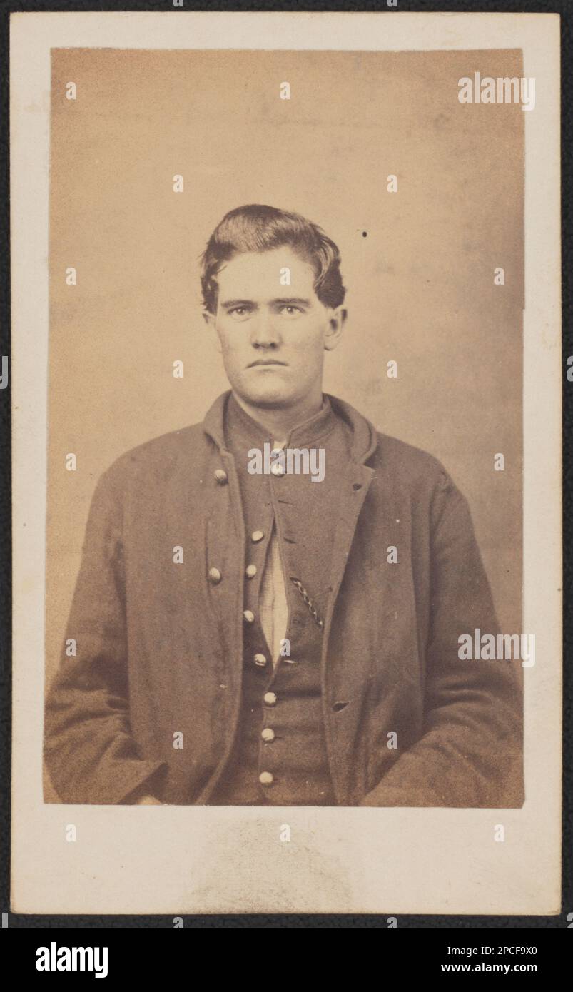 Corporal James W. Bailey von Co E, 81. Ohio-Infanterie-Regiment in Uniform. Liljenquist Family Sammlung von Bürgerkriegsfotos, pp/liljpaper. Bailey, James W, 1842-1915, USA, Armee, Ohio Infanterie-Regiment, 81. (1861-1865), Volk, Soldaten, Union, 1860-1870, Militäruniformen, Union, 1860-1870, Vereinigte Staaten, Geschichte, Bürgerkrieg, 1861-1865, Militärpersonal, Union. Stockfoto