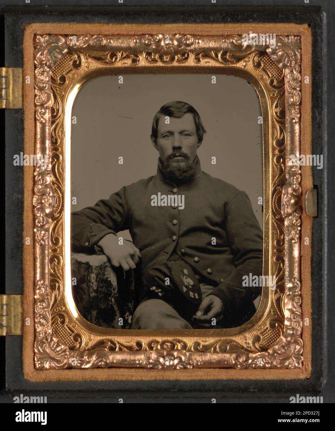 Nicht identifizierter Soldat mit amputierten Fingern in Gewerkschaftsuniform mit Co D, New Hampshire Volunteers Regiment Hut. Liljenquist Family Sammlung von Bürgerkriegsfotos, FAmbrotype/Tintype Fotoserie, pp/liljunion. Usa, Armee, Volk, 1860-1870, Soldaten, Union, 1860-1870, Militäruniformen, Union, 1860-1870, Amputierte, 1860-1870, Kriegsopfer, 1860-1870, Vereinigte Staaten, Geschichte, Bürgerkrieg, 1861-1865, Medizinische Aspekte, Union, USA, Geschichte, Bürgerkrieg, 1861-1865, Militärpersonal, Gewerkschaft. Stockfoto