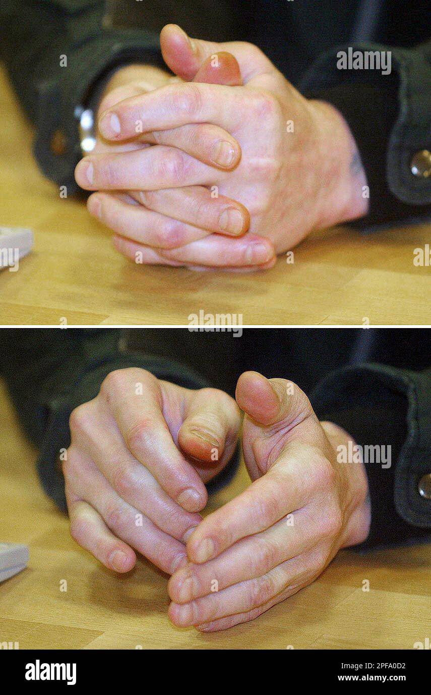 ** COMBO ** Die Haende des Schwerverbrechers Frank Schmoekel sind zu