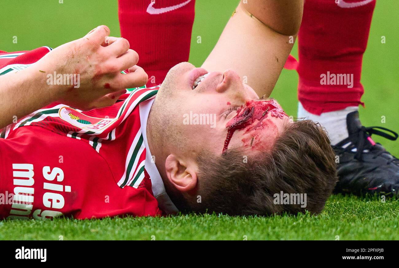Elvis Rexhbecaj, FCA 13 Kopfverletzung im Spiel FC AUGSBURG - FC SCHALKE 04 1. Deutsche Fußballliga am 18. März 2023 in Augsburg. Staffel 2022/2023, Spieltag 24, 1. Bundesliga, 24. Spieltag © Peter Schatz / Alamy Live News - DFL-VORSCHRIFTEN VERBIETEN DIE VERWENDUNG VON FOTOS als BILDSEQUENZEN und/oder QUASI-VIDEO - Kredit: Peter Schatz/Alamy Live News Stockfoto