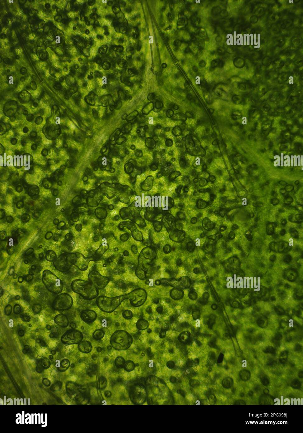 Pontische Rhodendron, Pontische Alpenrose, gemeiner Pontische Rhododendron (Rhododendron ponticum) mikroskopisches Bild von Zellen Stockfoto