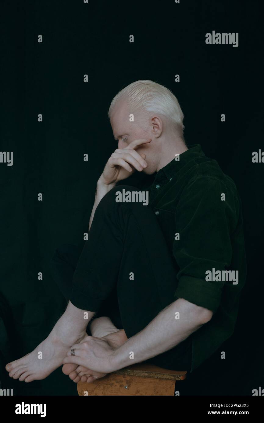 Ein Albino-Typ mit dunklem Hintergrund Stockfoto