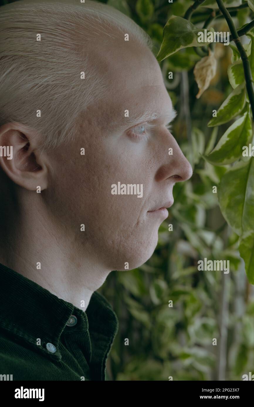Ein Albino-Typ mit grünen Pflanzen auf dunklem Hintergrund Stockfoto