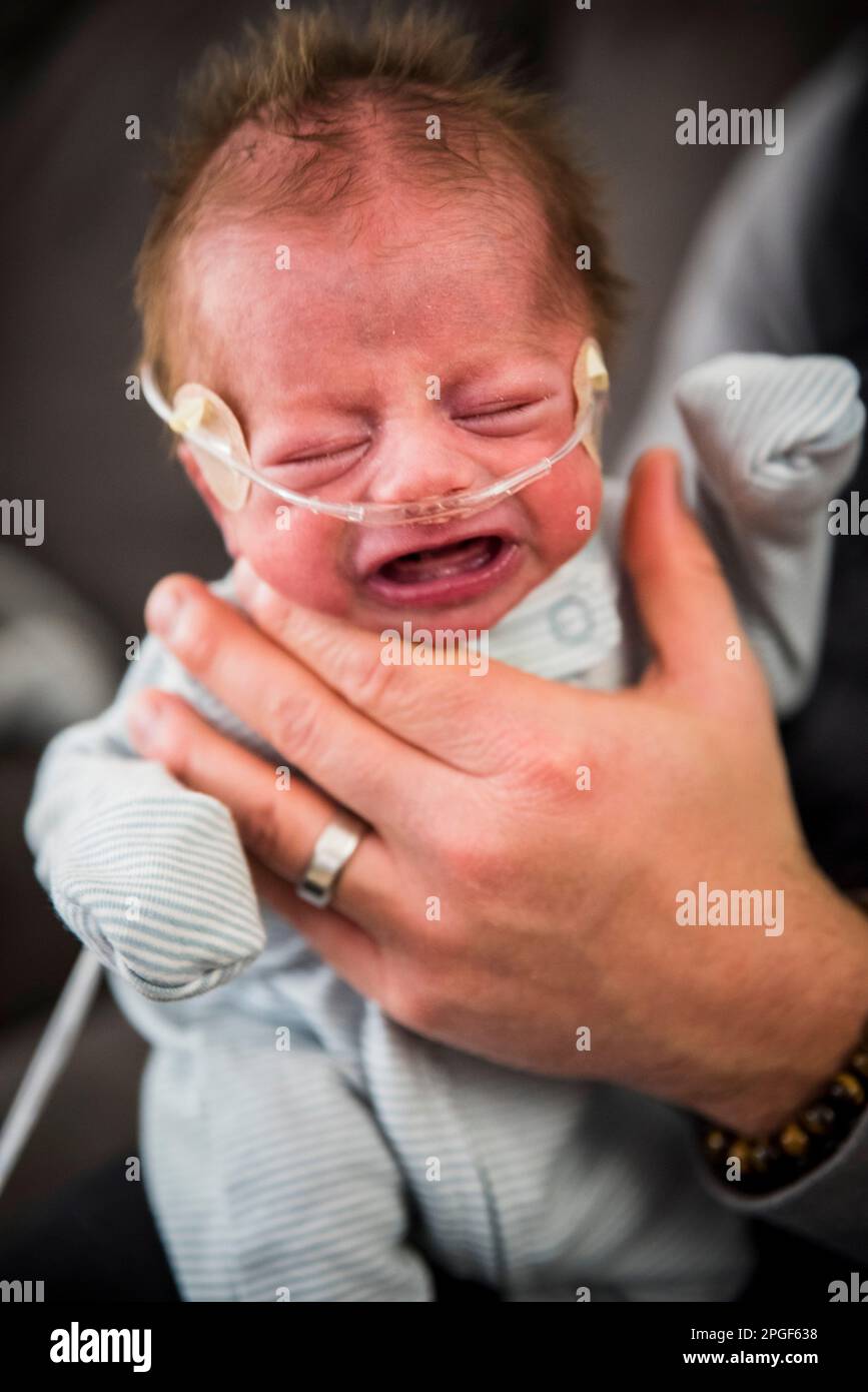 neugeborene auf der neugeborenen-intensivstation unter Sauerstofftherapie mit süßem Haar Stockfoto