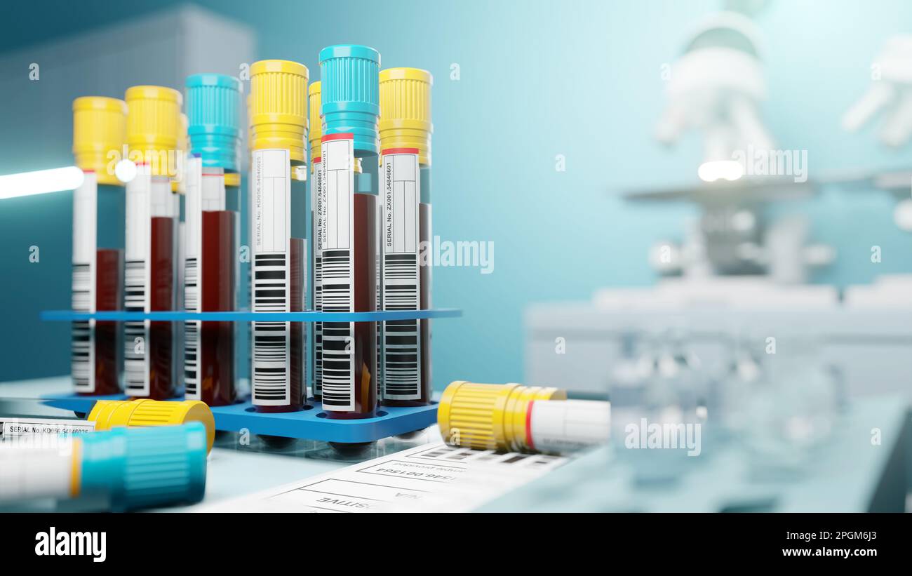 Reihen von Blutproben in einem Labor, das für medizinische Zwecke gescreent und getestet wird. 3D Abbildung Stockfoto