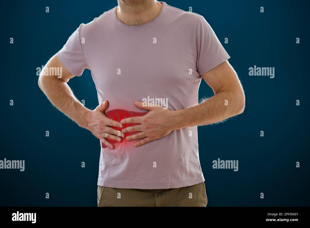 Der Mann, der seinen Magen vor Schmerzen hält. Männlicher Körper mit dem Bild einer entzündlichen Leber. Medizinisches Konzept Stockfoto