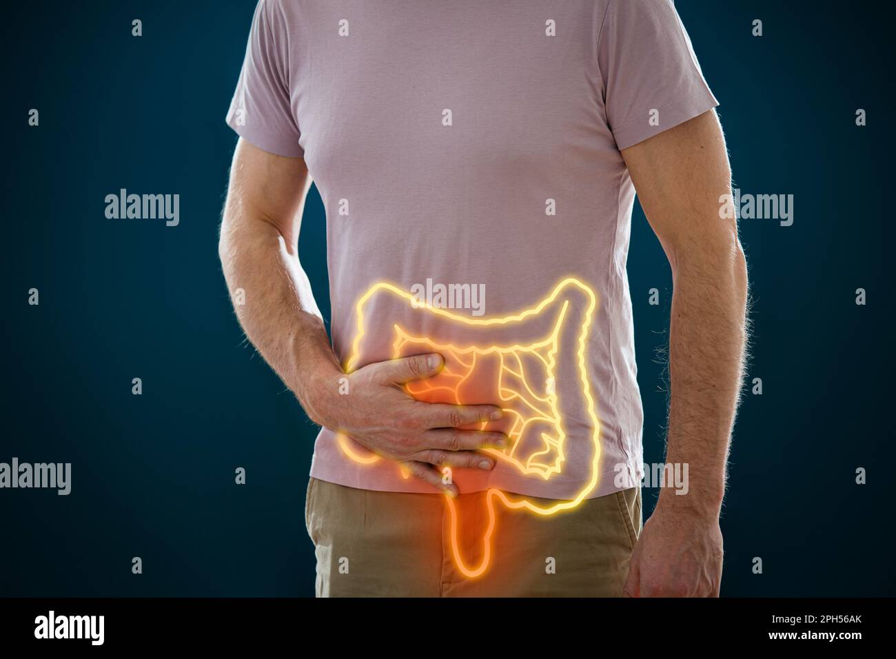 Der Mann, der seinen Magen vor Schmerzen hält. Männlicher Körper mit dem Bild eines Verdauungssystems und entzündlicher Darm. Medizinisches Konzept Stockfoto