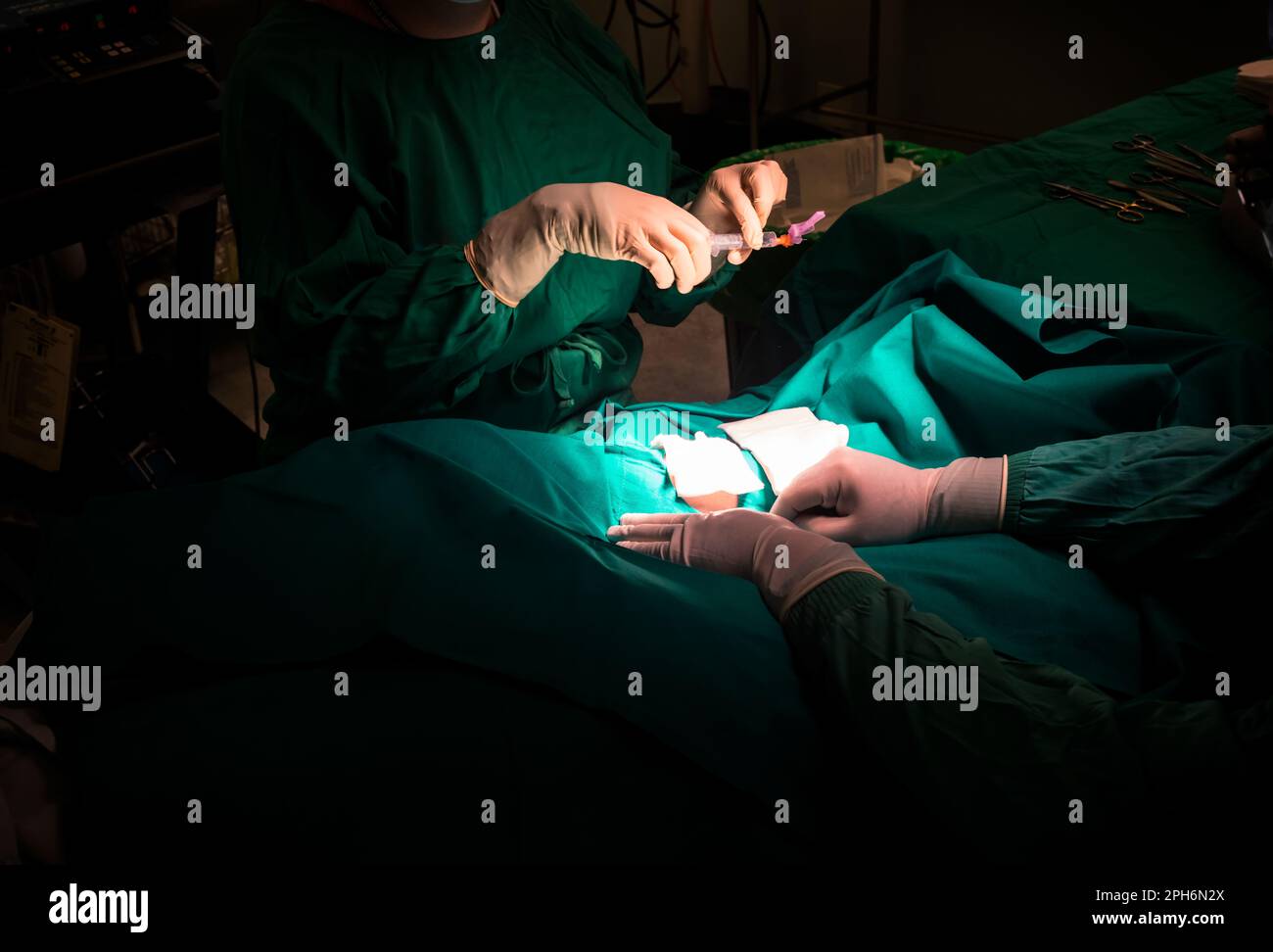 Chirurgen-Hände zur Vorbereitung der Lokalanästhesie bei dermatologischen Läsionsoperationen auf einem Feld steriler Grünblätter. Einstellen der subkutanen Nadel i Stockfoto