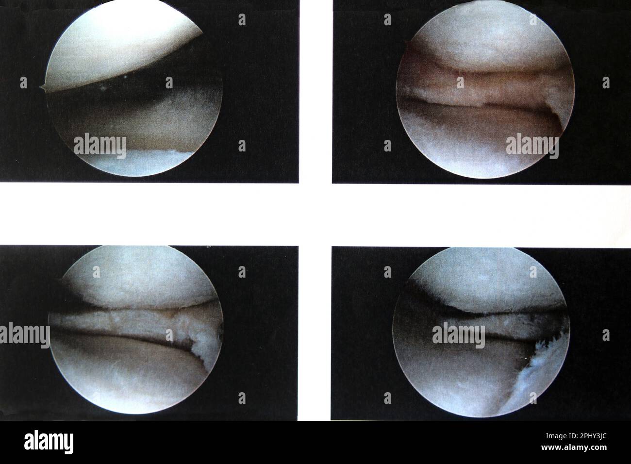 , Arthroskopie Stockfoto