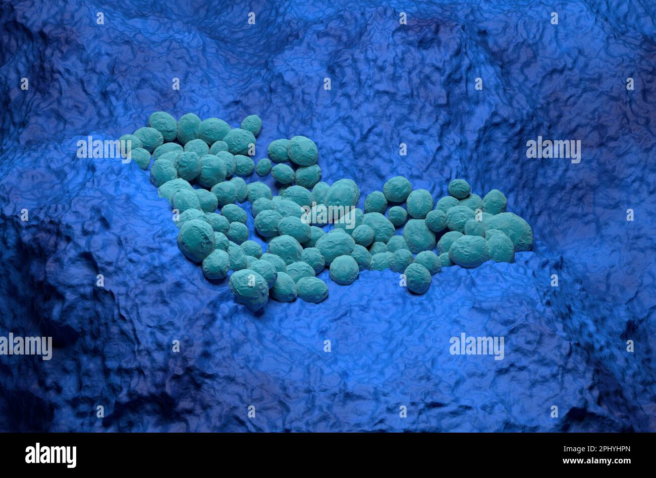 Lungenkrebs (LC) im Lungengewebe - isometrische 3D-Darstellung Stockfoto