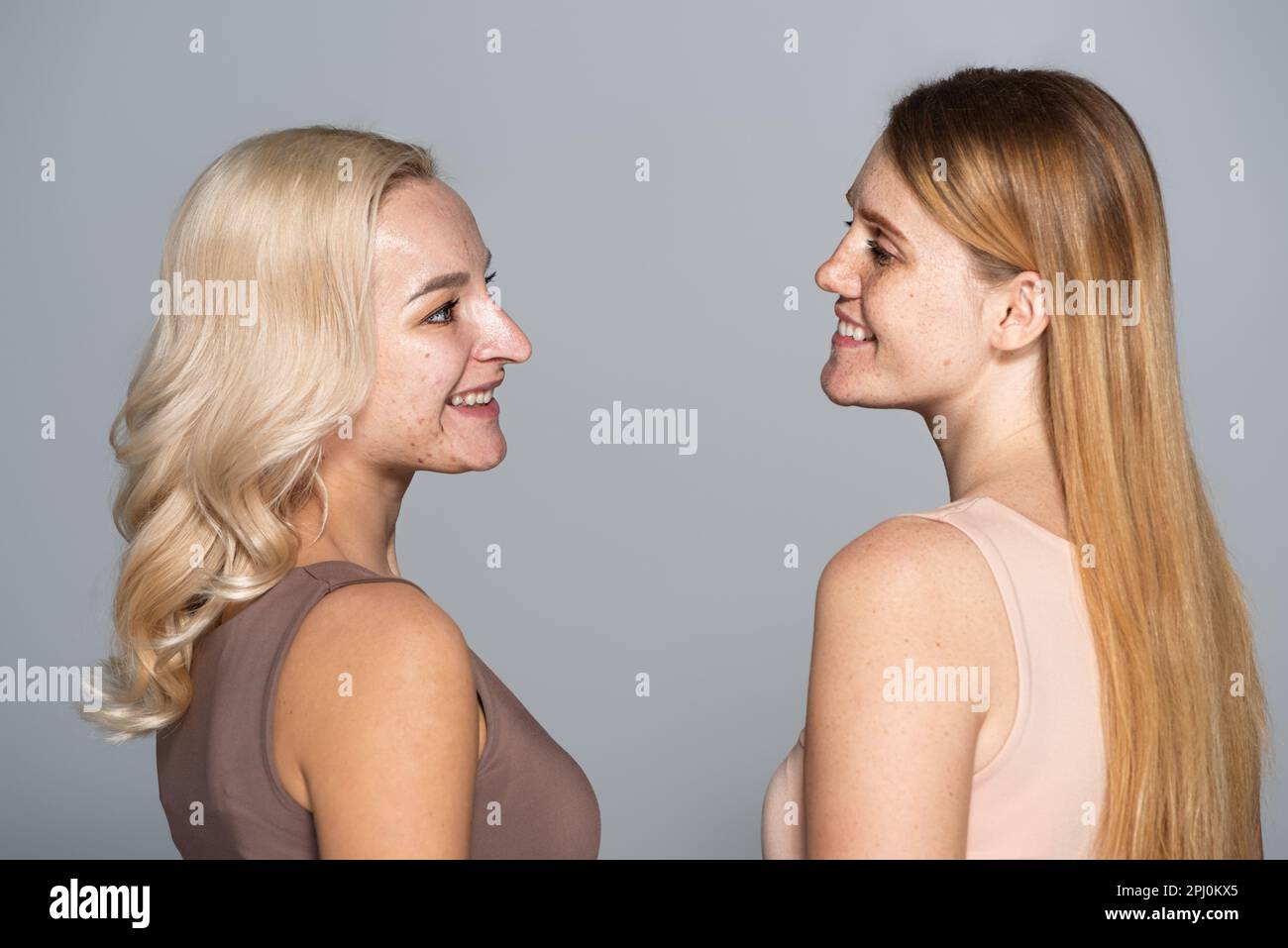 Seitenansicht von lächelnden Freunden mit Hautproblemen, die sich isoliert auf einem grauen Stockbild ansehen Stockfoto