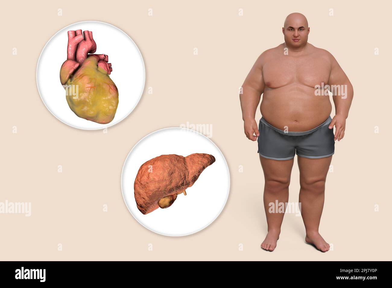 Body mass index Fotos und Bildmaterial in hoher Auflösung Seite 4 Alamy