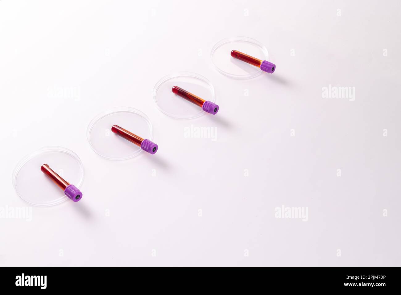 Reihe von Blutprobenröhrchen in Petrischalen auf weißem Hintergrund Stockfoto