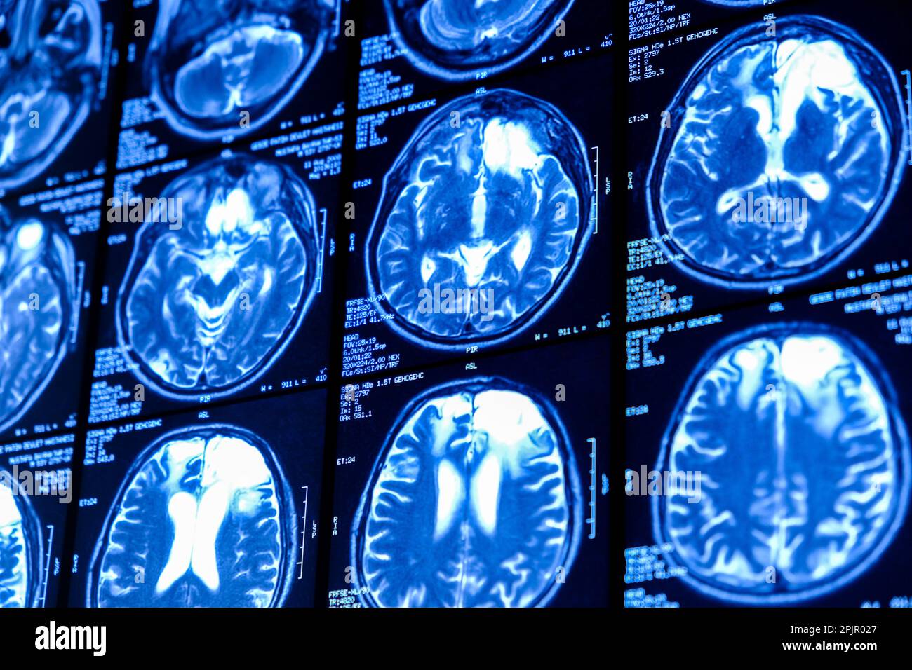 Nahaufnahme des CT-Scans mit Gehirn. Medizin, Wissenschaft und Ausbildung MRT-Hirnhintergrund. Magnetresonanztomographie. Tomographie-Aufnahme. Stockfoto