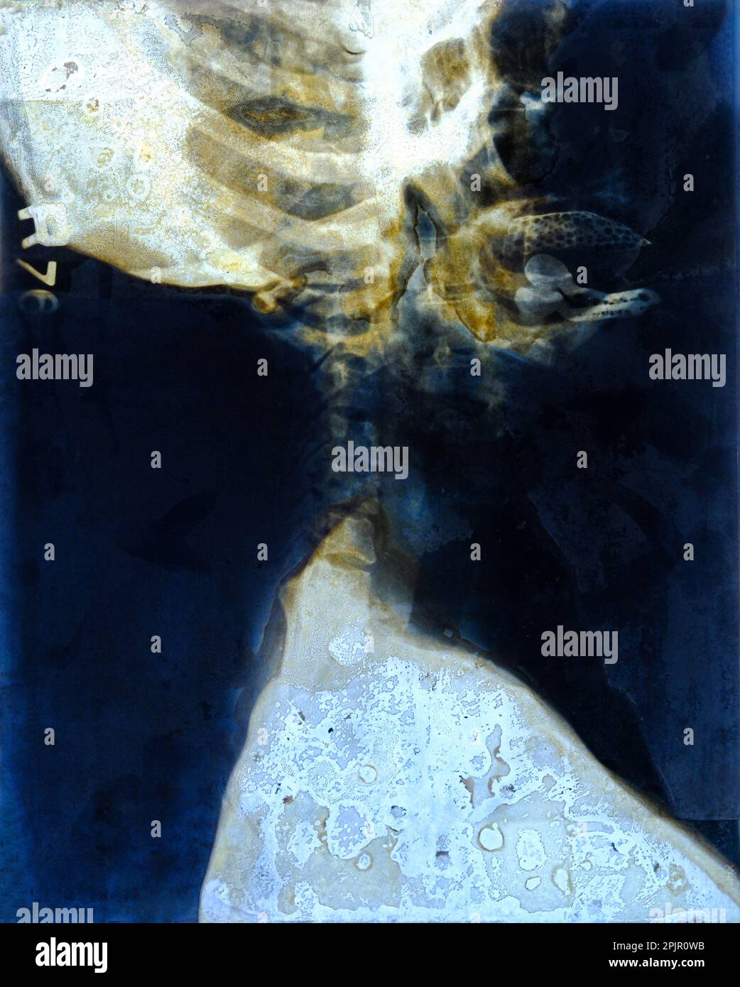 Film Röntgen Schädel und Halswirbelsäule Seitenansicht Stockfoto