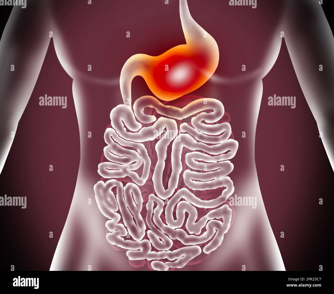 Illustration einer Frau mit Magenkrankheiten. Gastroenterologie Stockfoto