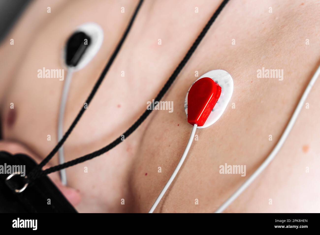 Holter-Herzmonitor. Nahaufnahme der Sensoren. Arrhythmie Stockfoto