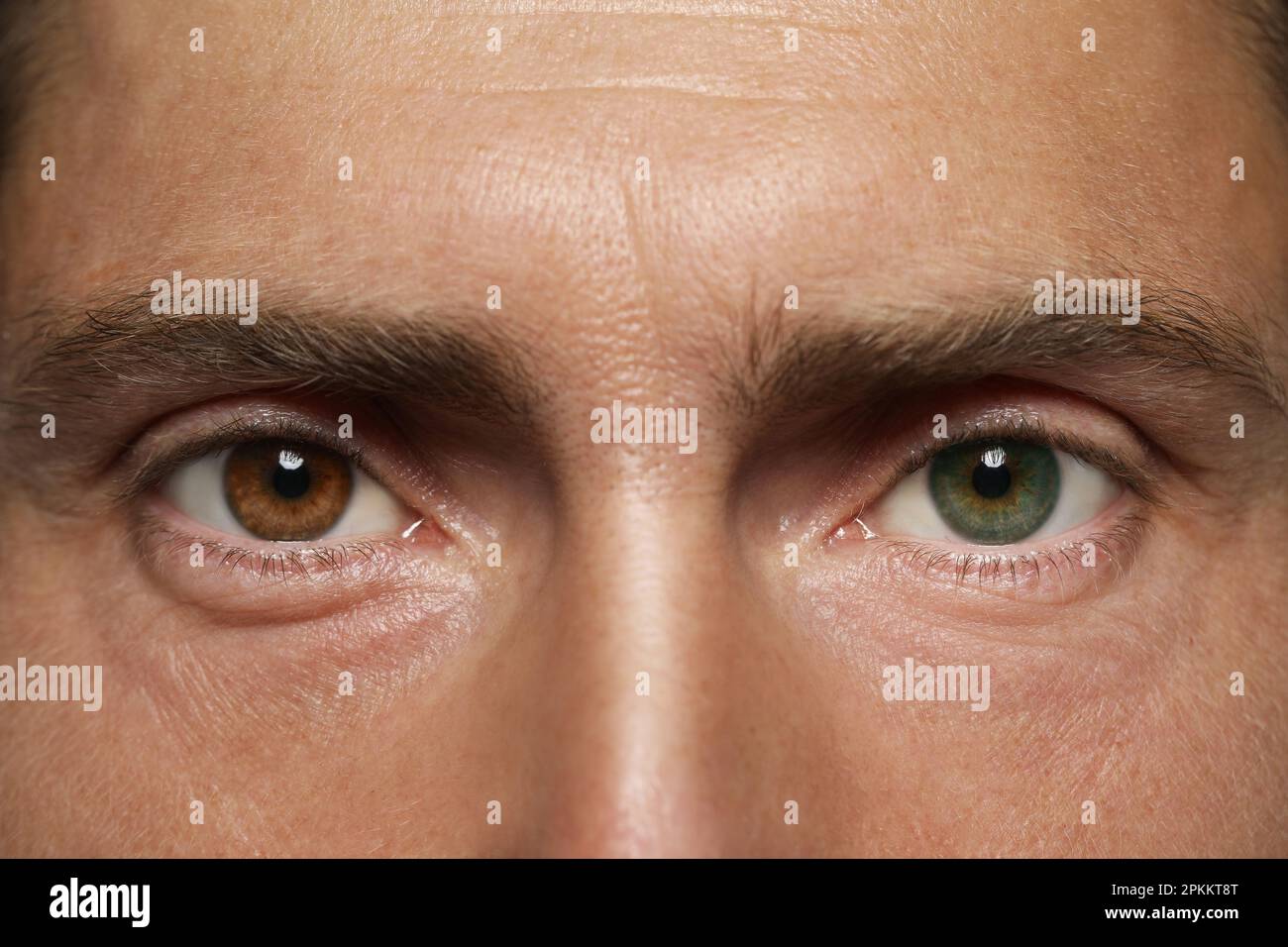 Mann mit schönen Augen in verschiedenen Farben, Nahaufnahme. Heterochromia iridis Stockfoto