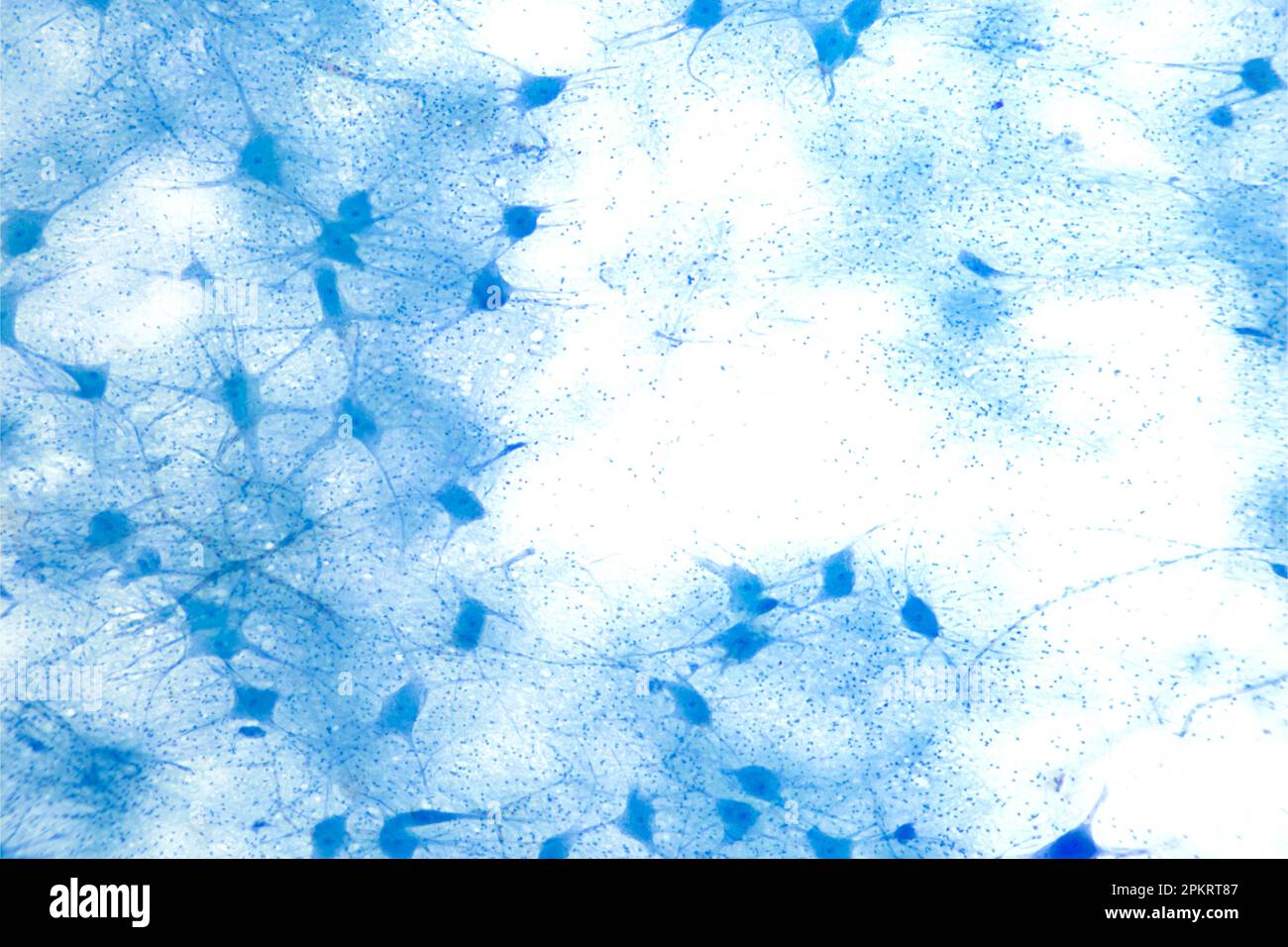 neuronzellen, Ganzkörper, 8X-Lichtmikroskop. Motoneurone unter dem Lichtmikroskop. Motorische Neurozellen, auch efferente Neuronen genannt. Stockfoto