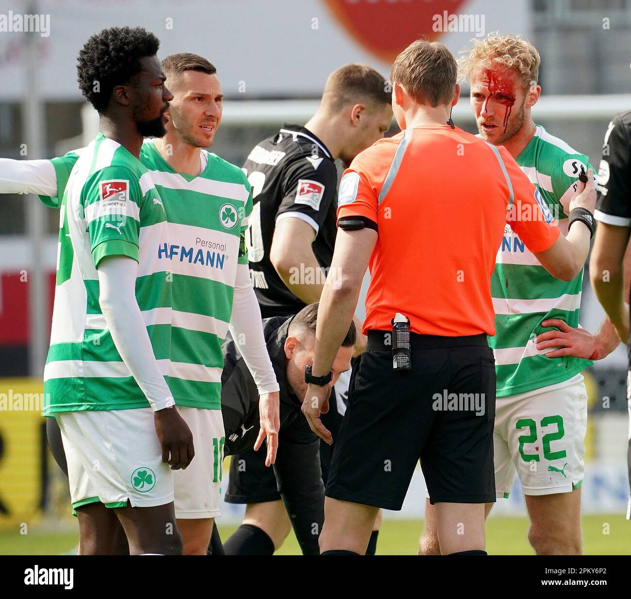 9. April 2023, BWT-Stadion am Hardtwald, Sandhausen, GER, 2. Division, SV Sandhausen gegen Greuther Furth, DFL-Vorschriften verbieten die Verwendung von Fotos als Bildsequenzen und/oder quasi-Video. Im Film unterbricht Martin Petersen das Spiel wegen einer blutigen Schnittwunde am Kopf von Sebastian Griesbeck (Furth). Stockfoto