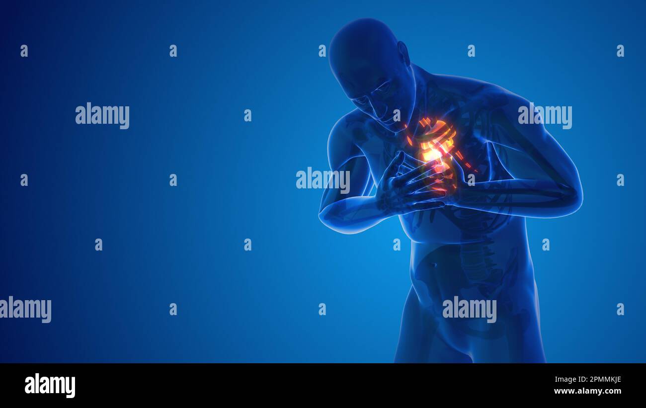 Herzinfarktschmerz in der Brust Stockfoto
