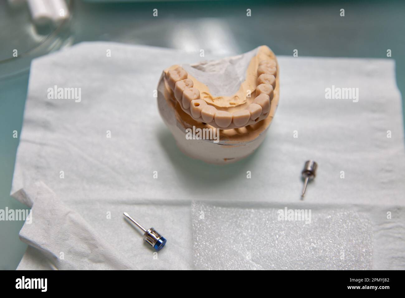 Kunststoffmodell einer Keramik-Metall-Dauerprothese an der Implantatnaht Stockfoto