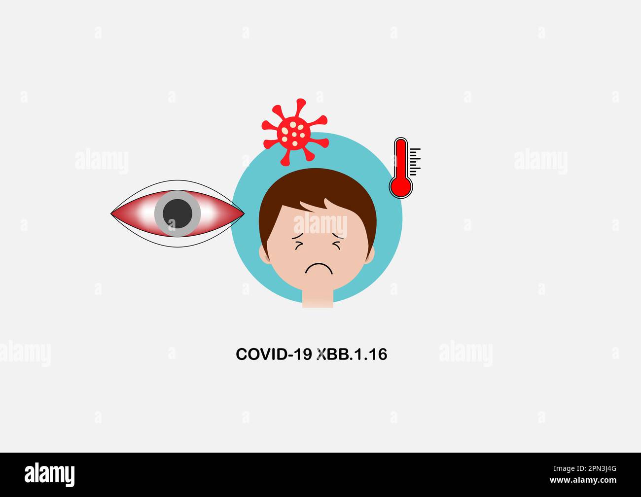 Covid-19 XBB.1,16-Variante als Ursache juckender Konjunktivitis oder Pinkeye und hohem Fieber bei Kindern. Vektordarstellung. Stock Vektor
