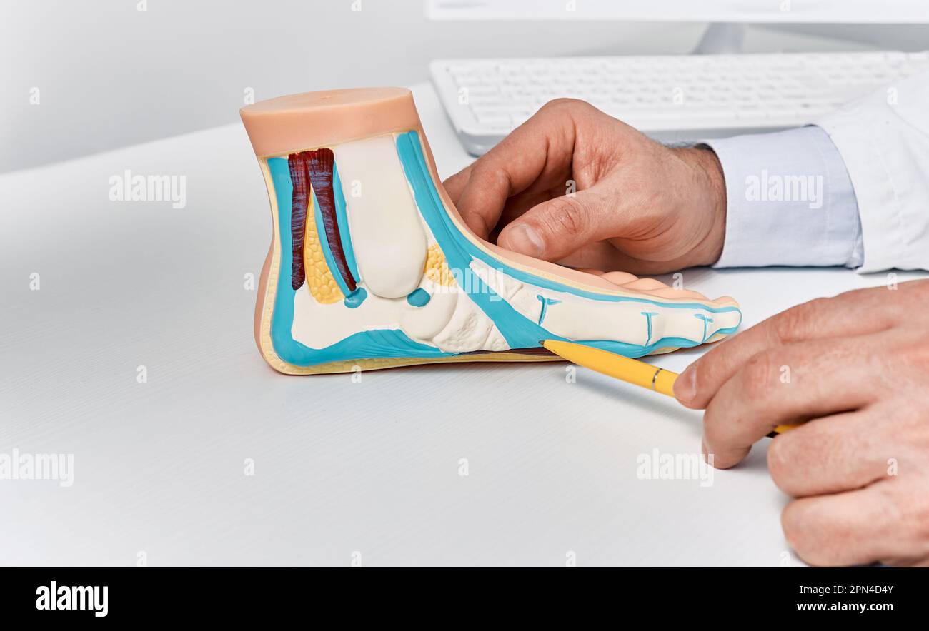 Anatomisches Flachfußmodell auf dem Arzttisch während der Sprechstunde im Orthopädie-Zentrum. Behandlung von Flachfüßen und pes planus Stockfoto