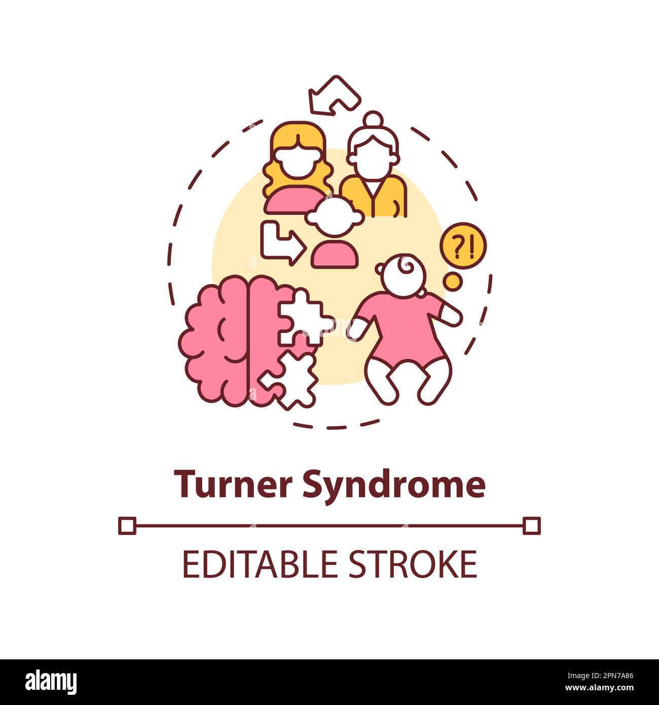 Das Turner-Syndrom-Konzeptsymbol Stock Vektor