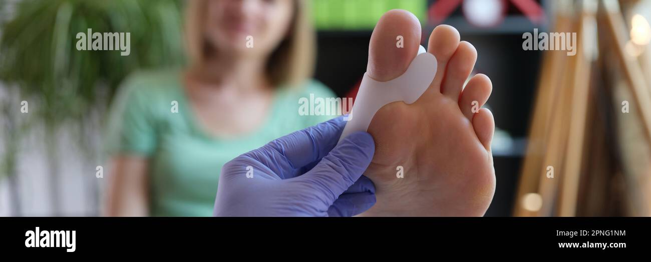 Orthopäde untersucht Bein mit Hallux Valgus-Deformität der Großzehe Stockfoto