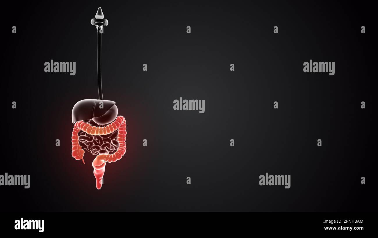 Menschlicher Körper mit Dickdarm Stockfoto
