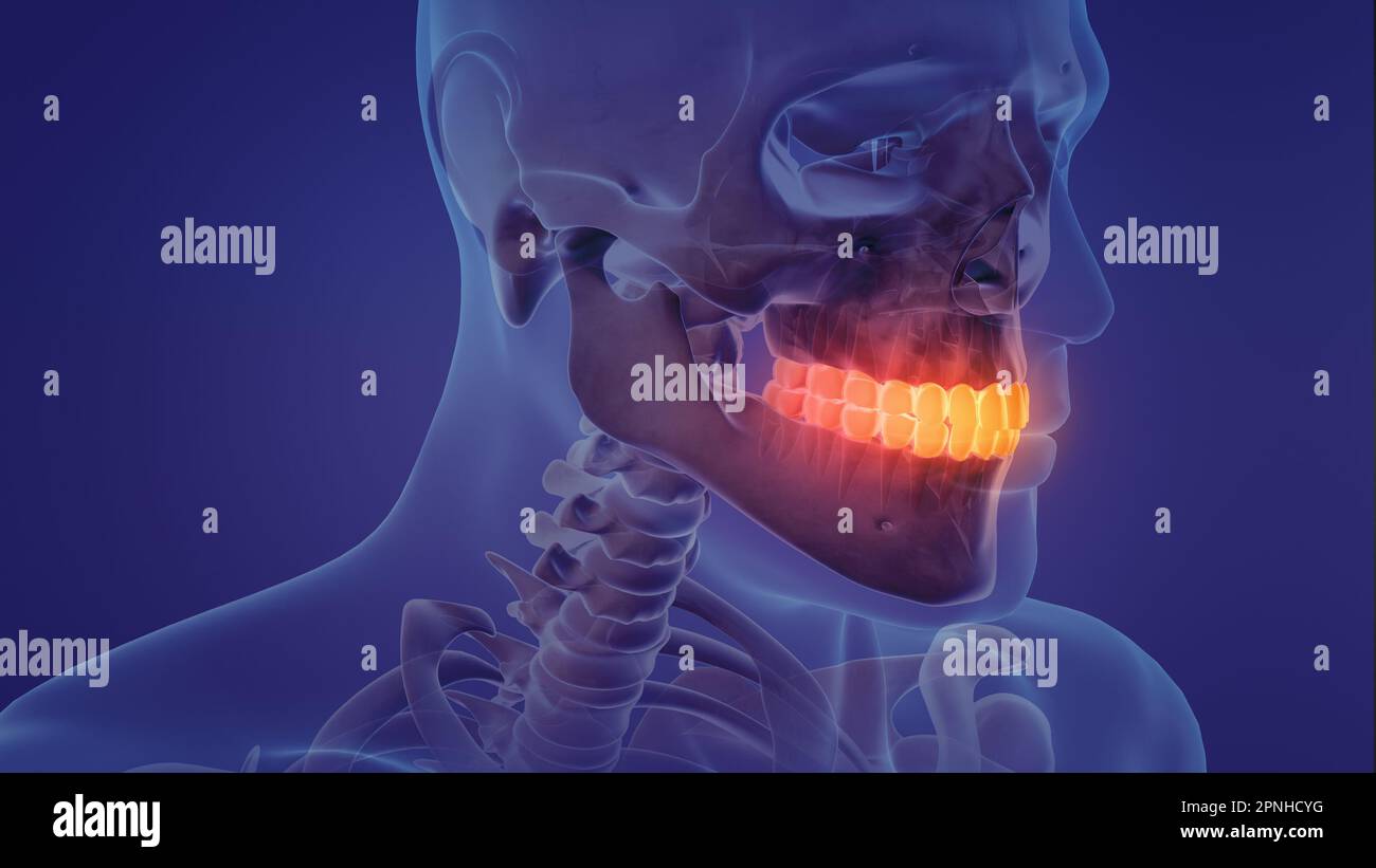 Animation eines schmerzhaften Zahnes Stockfoto