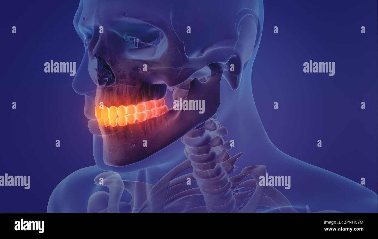 Animation eines schmerzhaften Zahnes Stockfoto