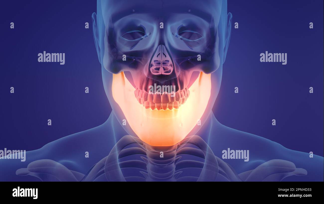 Animation eines schmerzhaften Unterkiefers Stockfoto