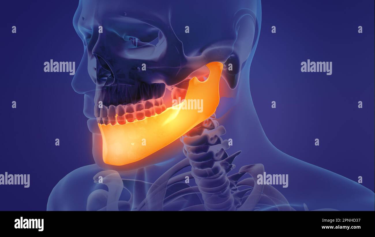 Animation eines schmerzhaften Unterkiefers Stockfoto