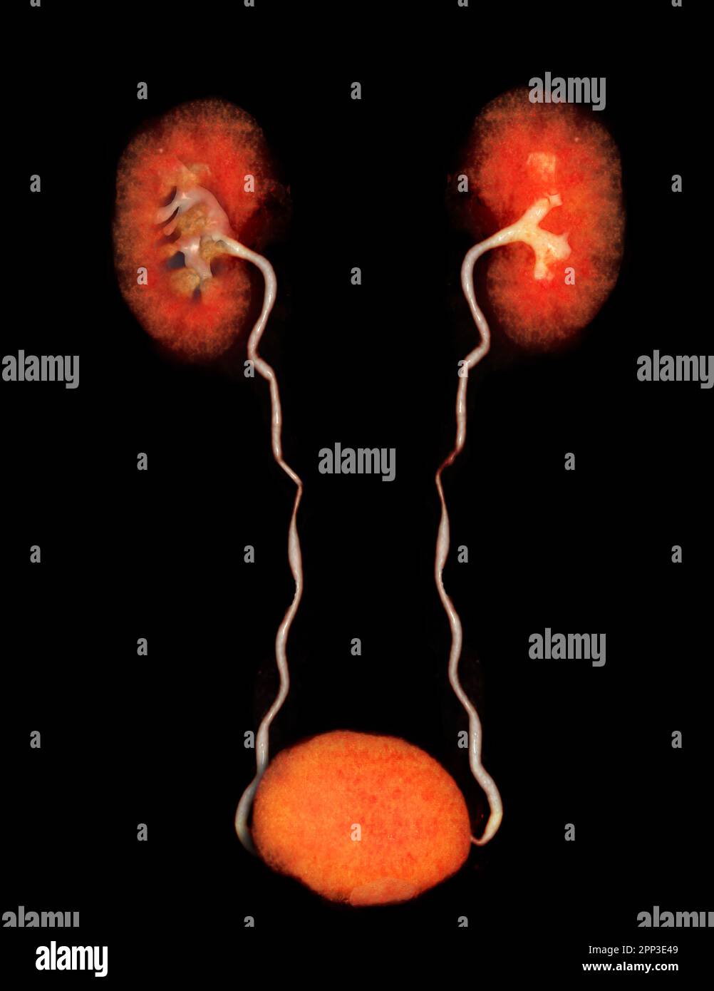 CTA Arteria renalis 3D-Rendering-Bild mit Niere, Harnleiter und Blase. Stockfoto