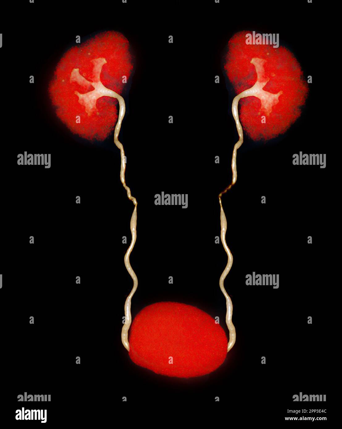CTA Arteria renalis 3D-Rendering-Bild mit Niere, Harnleiter und Blase. Stockfoto