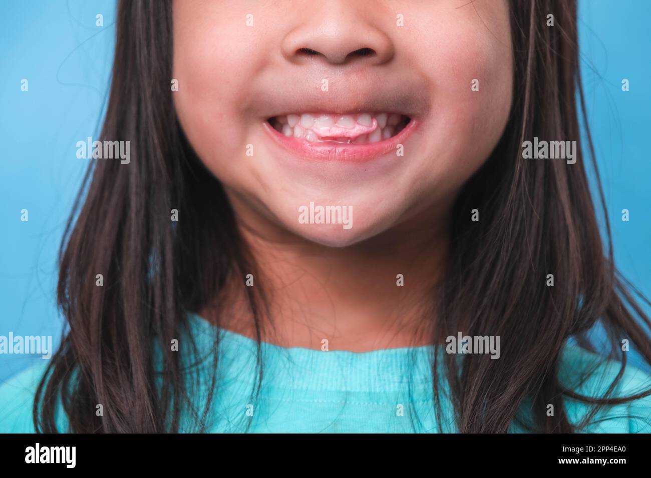 Lächelndes, süßes kleines Mädchen, das süße Gelatine mit Zucker auf blauem Hintergrund isst. Kinder essen zuckerhaltige Süßigkeiten, was zu Zahnverlust oder Zahnverlust führt Stockfoto