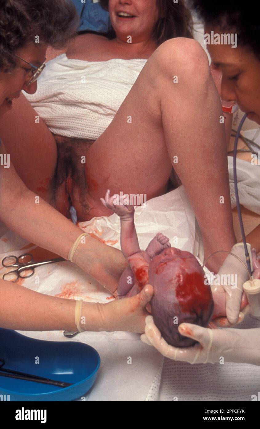 Junge Frau gebärt im Krankenhaus, Hebammen gebären Baby Stockfoto