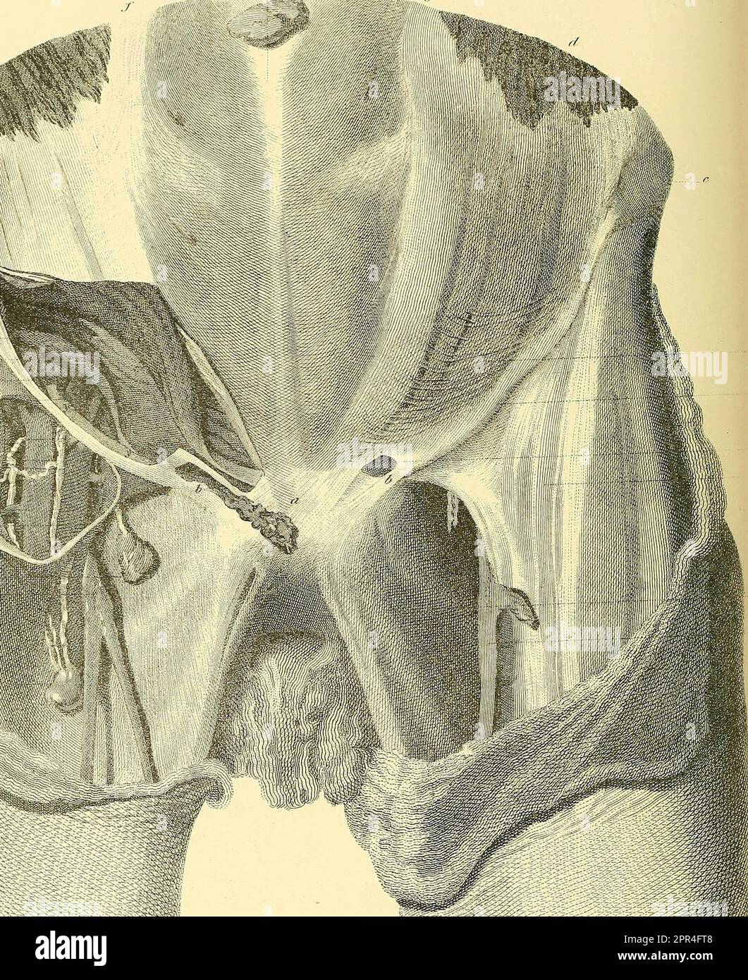 Die anatomie und chirurgische behandlung von hernien -Fotos und