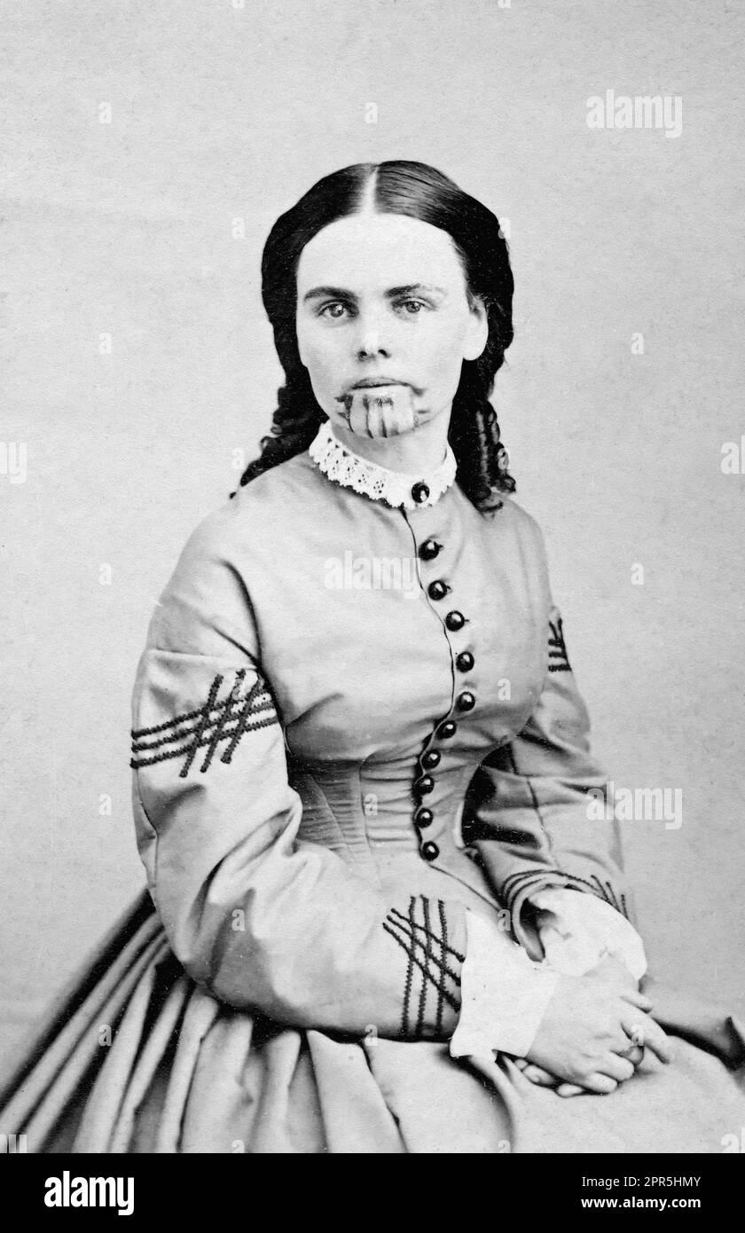 Olive Oatman. Porträt der amerikanischen Frau, die von den Ureinwohnern als Teenager gefangen wurde, Olive Ann Oatman (1837-1903), c. 1863 Stockfoto