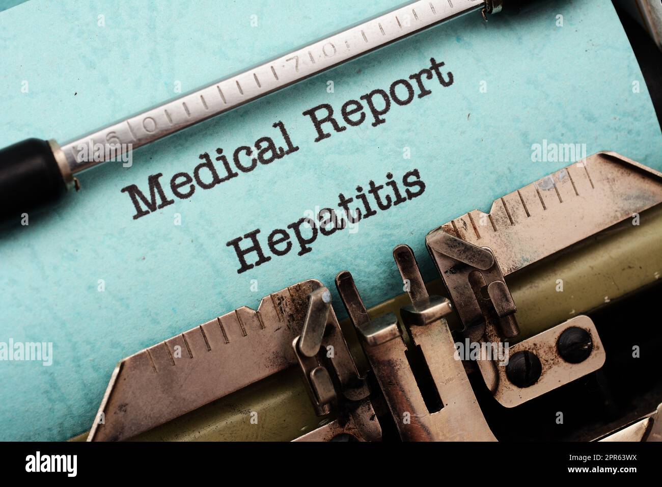 Hepatitis Stockfoto