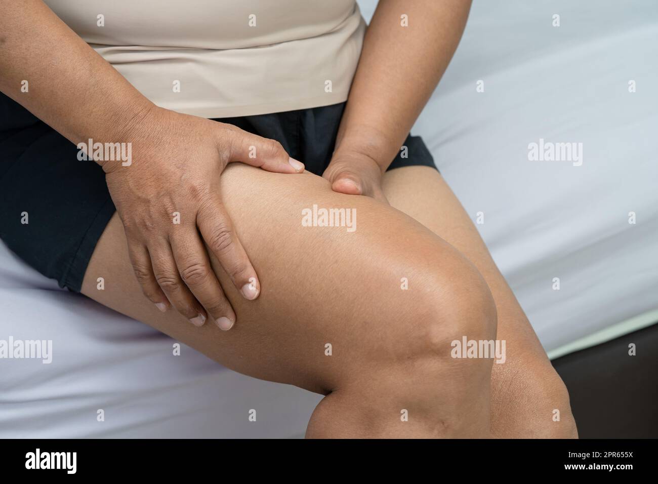 Asiatische Dame Frau Patientin berühren und fühlen Schmerzen ihr Knie, gesundes medizinisches Konzept. Stockfoto