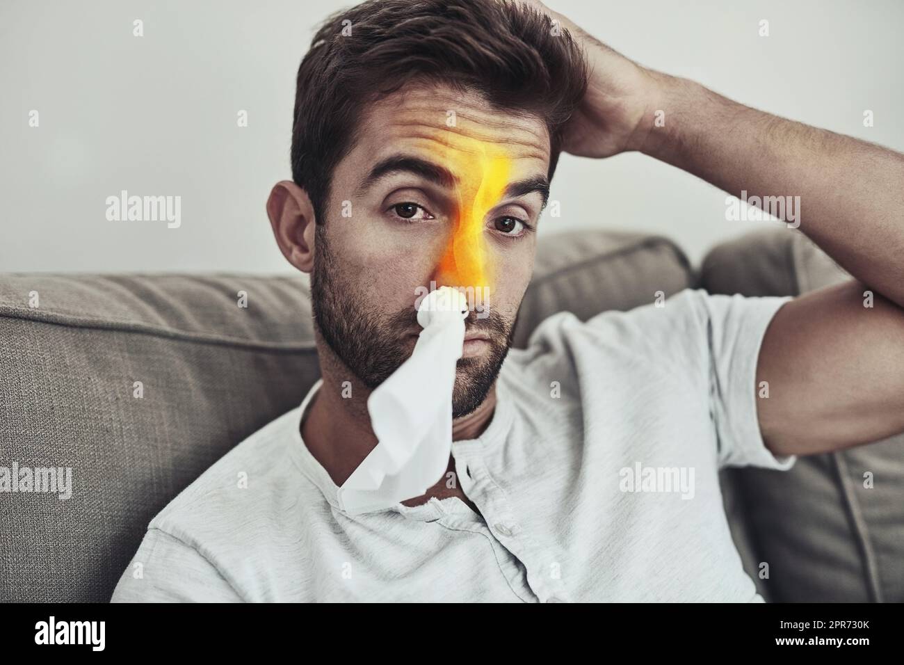 Sieht wieder wie seine Grippesaison aus. Porträt eines unglücklichen jungen Mannes, der aufgrund von Nasennebenproblemen ein Gewebe in der Nase trägt. Stockfoto