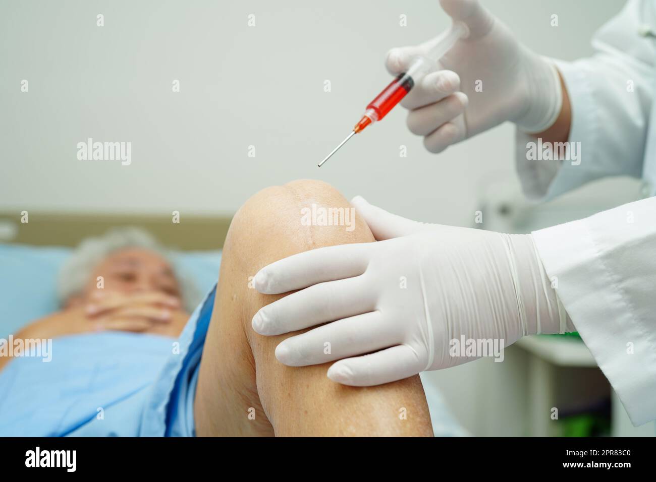 Arzt untersucht asiatische ältere Frau Patienten mit Narbe Knieersatz-Operation im Krankenhaus. Stockfoto
