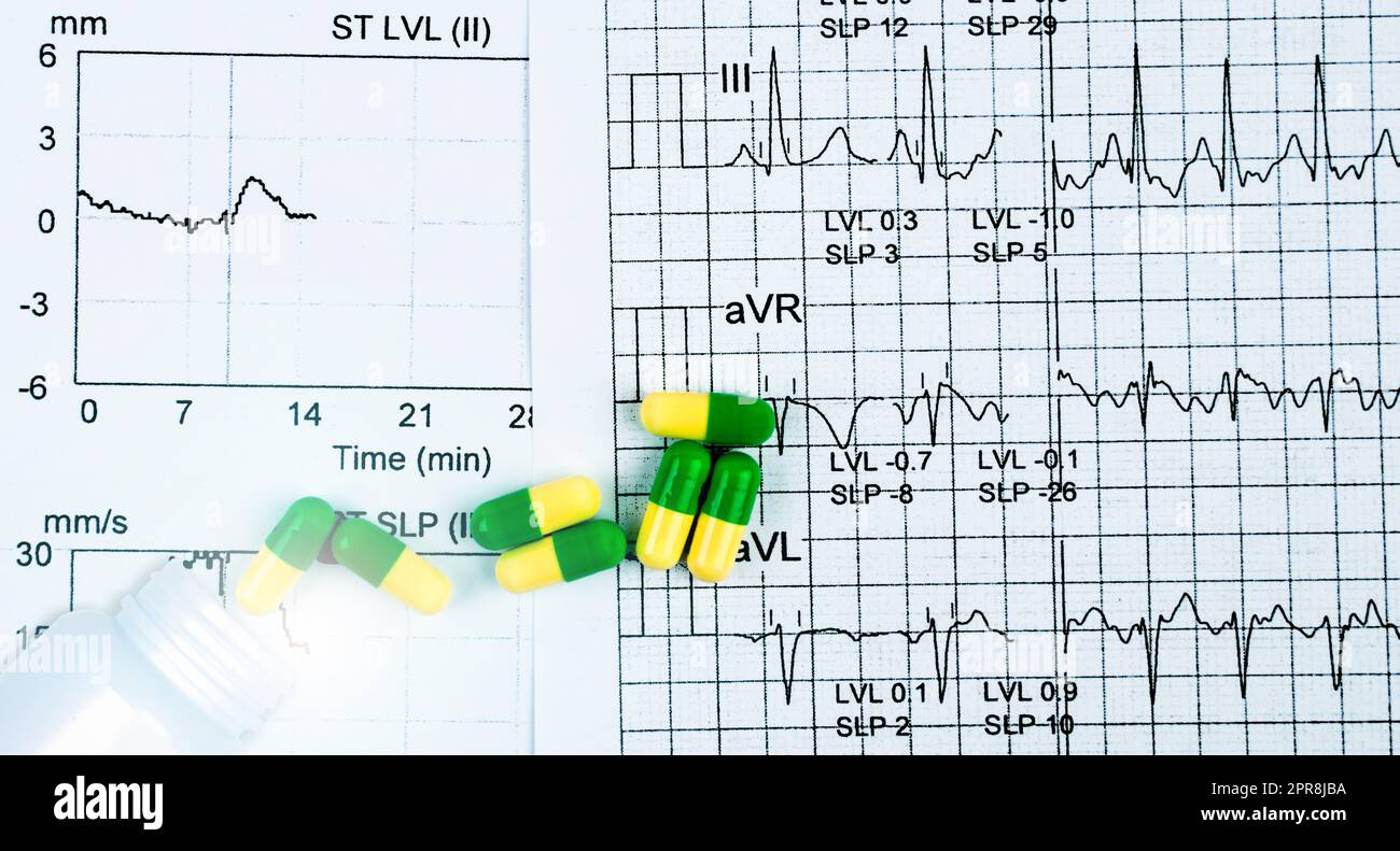 Grün-gelbe Kapselpillen sind aus weißer Plastikflasche auf EKG- oder EKG-Schreiber-Berichtspapier verteilt. Medizinische Wirkung auf die Herzfunktion. Herzmedikationskonzept. Pharmakologie. Verschreibungspflichtige Medikamente. Stockfoto
