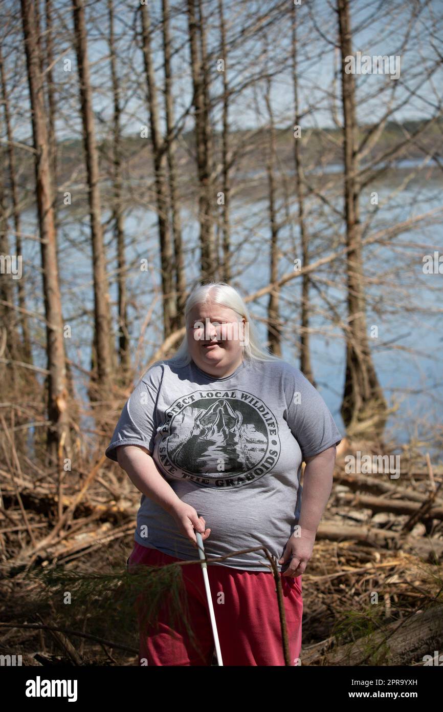 Albino-Frau, die einen Stock hält und vor einer Baumgrenze in der Nähe eines Ufers lächelt Stockfoto