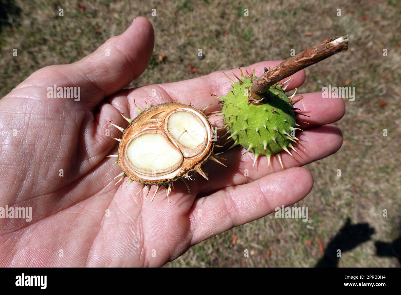 Kastanie (Aesculus hippocastanum) mit einer Zwillingsfrucht auf einer Handfläche Stockfoto